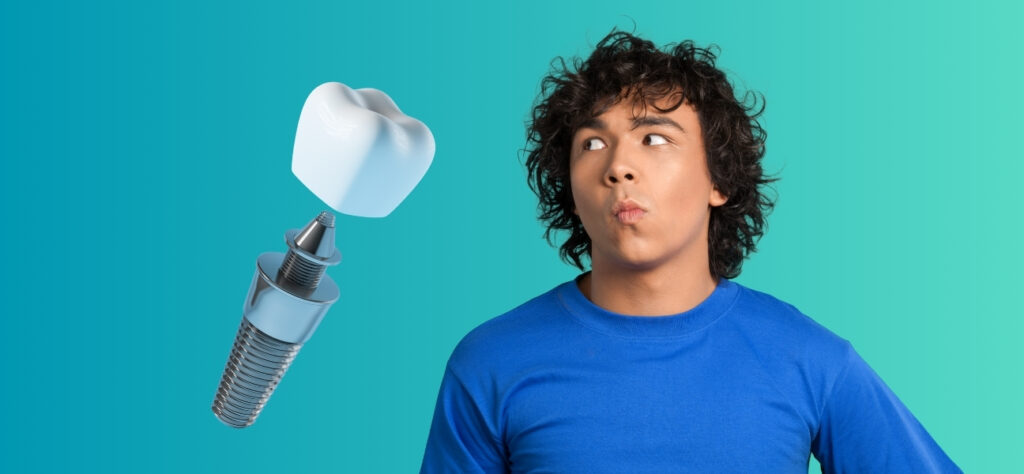 How Long Do All on 4 Implants Last