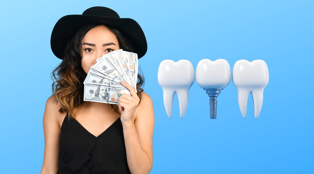 How Much Is All on 4 Dental Implants: Affordable Options