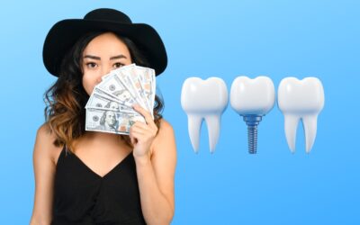 How Much Is All on 4 Dental Implants: Affordable Options