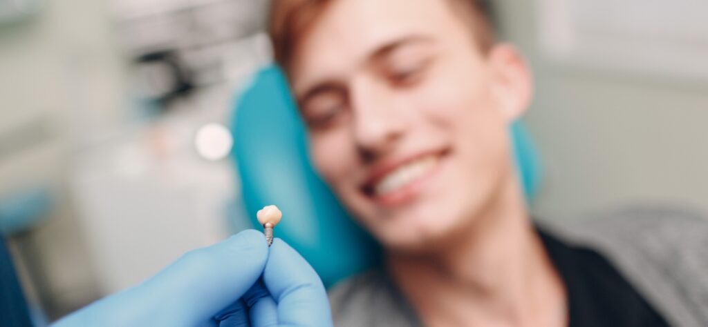 How Much Is All On 4 Dental Implants