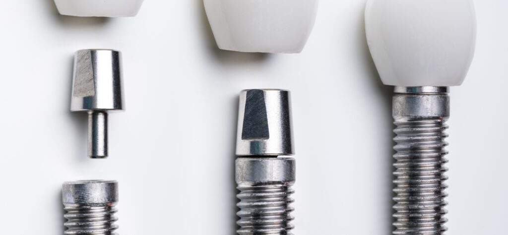How to Clean All on 4 Dental Implants