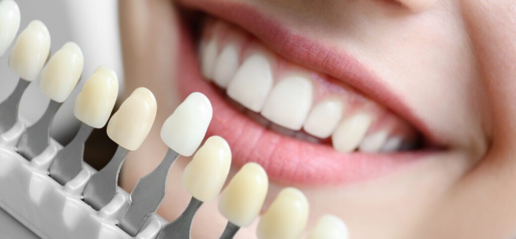 Dental Crown Procedure