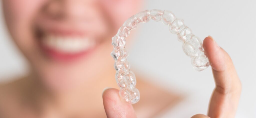 Byte vs Invisalign