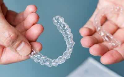 How Does Invisalign Work: A Clear Guide to Straightening Teeth