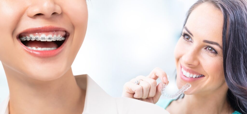 How Does Invisalign Work