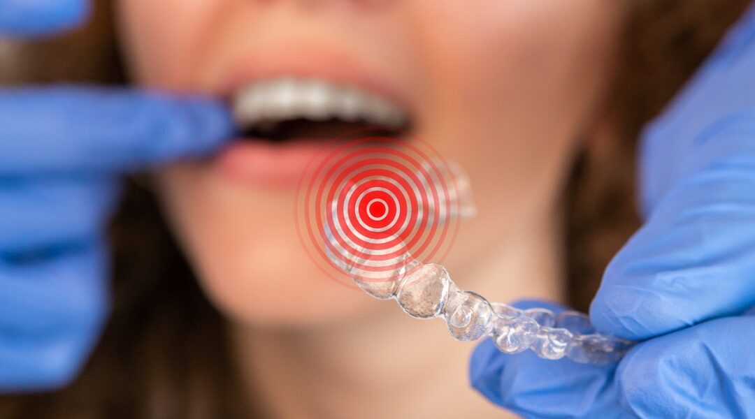 How Long Does Invisalign Hurt: The Truth Behind Discomfort