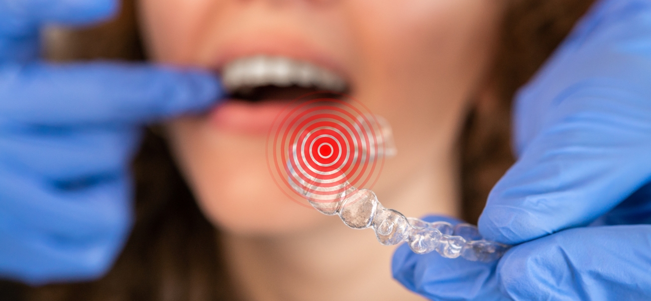 How Long Does Invisalign Hurt