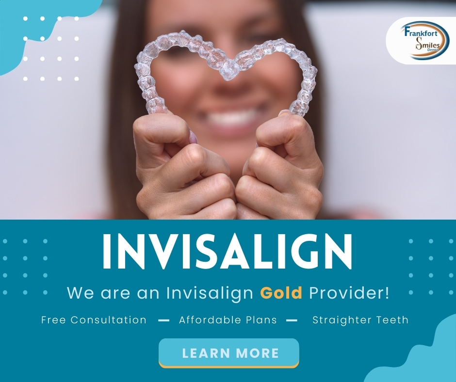 Invisalign in Frankfort