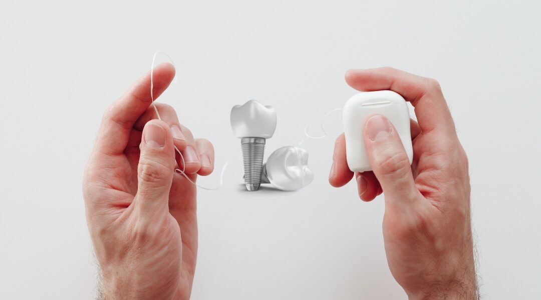 How to Floss All on 4 Dental Implants: A Step-by-Step Guide