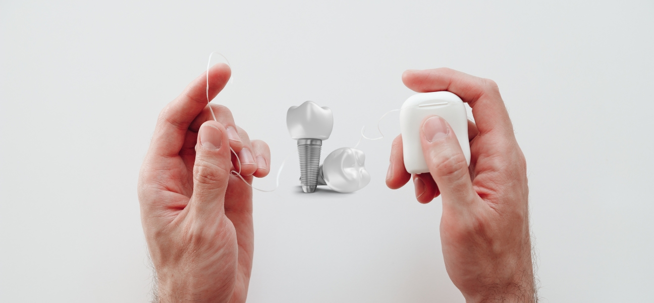 How To Floss All on 4 Dental Implants