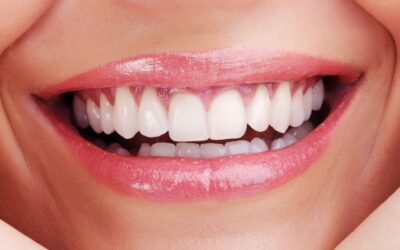 How Do Dentists Number Teeth: Understanding the Universal Numbering System